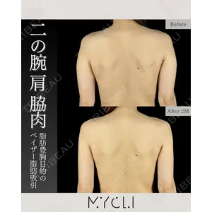 MYCLI【マイクリ】 本田マイケル武史医師の症例