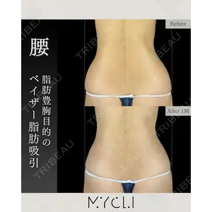MYCLI【マイクリ】 本田マイケル武史医師の症例