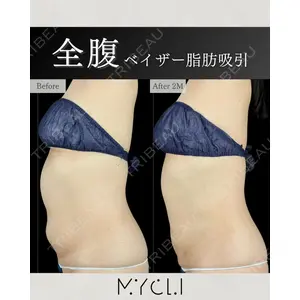 MYCLI【マイクリ】 本田マイケル武史医師の症例