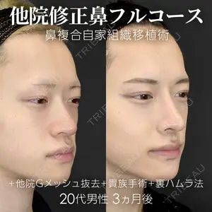 ジョウクリニック 銀座院 重本　譲医師の症例