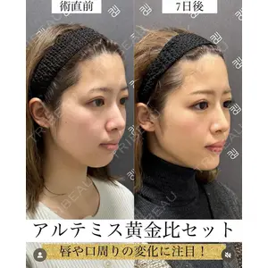 EMMO FACE CLINIC 大宮院 廣松 直樹医師の症例