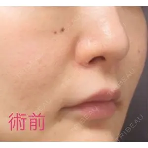 銀座TAクリニック 山田 真里江医師の症例