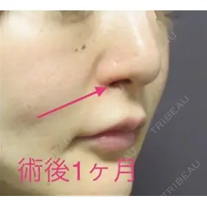 銀座TAクリニック 山田 真里江医師の症例