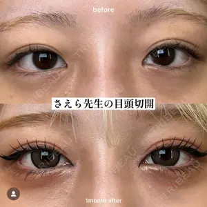 EMMO FACE CLINIC 大阪梅田院 山﨑 冴羅医師の症例