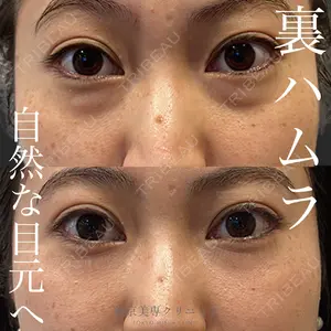 東京美専クリニック 土田 諒平医師の症例