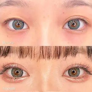 東京シンデレラ美容外科 池袋院の症例