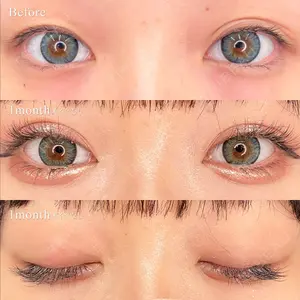 東京シンデレラ美容外科 池袋院の症例