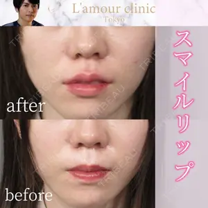 L‘amour clinic Tokyo【ラムールクリニック東京】の症例