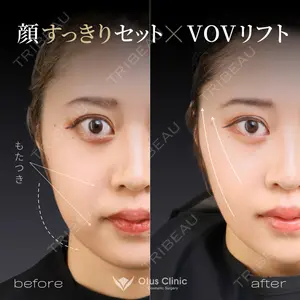 Otus Clinic 【オータスクリニック】 中 徳太郎医師の症例