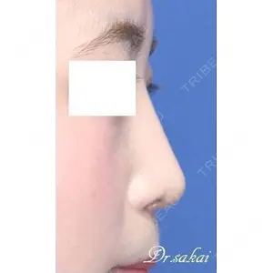 銀座S美容・形成外科クリニック 酒井 直彦医師の症例