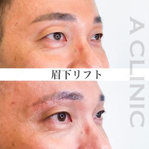 A CLINIC（エークリニック） 新宿院 山田 哲雄医師の症例
