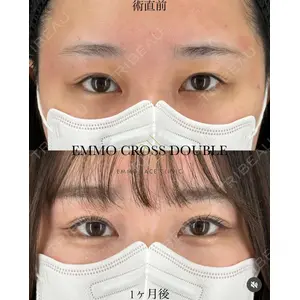 EMMO FACE CLINIC 大宮院 廣松 直樹医師の症例