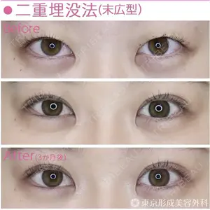 東京形成美容外科 船橋院 山崎 修吾医師の症例