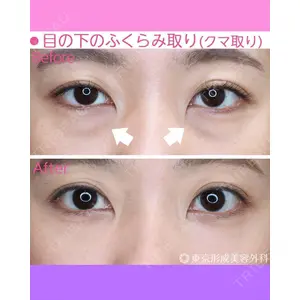 東京形成美容外科 船橋院 山崎 修吾医師の症例