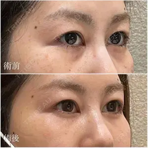 お茶の水美容形成クリニックの症例