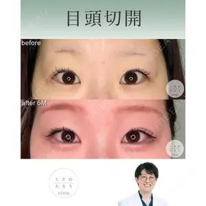くさのたろうクリニック 宮本　大医師の症例