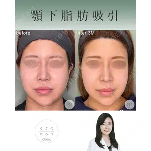くさのたろうクリニック 住永　莉華子医師の症例