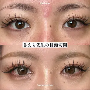 EMMO FACE CLINIC 大阪梅田院 山﨑 冴羅医師の症例