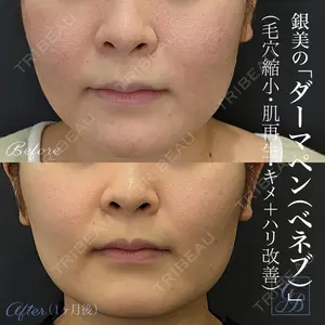 銀座美容外科クリニック 銀座院の症例
