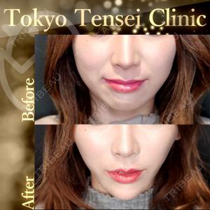 Tokyo Tensei Clinic 新宿院 辻 大成医師の症例