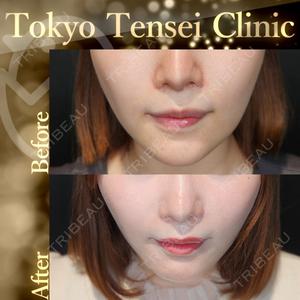 Tokyo Tensei Clinic 新宿院 辻 大成医師の症例