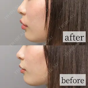 L‘amour clinic Tokyo【ラムールクリニック東京】の症例