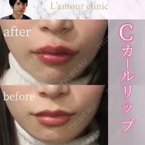 L‘amour clinic Tokyo【ラムールクリニック東京】の症例