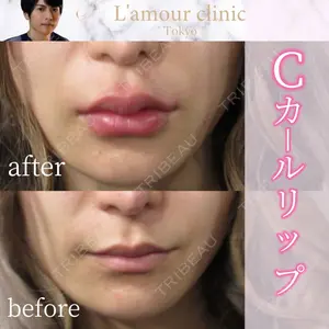 L‘amour clinic Tokyo【ラムールクリニック東京】の症例