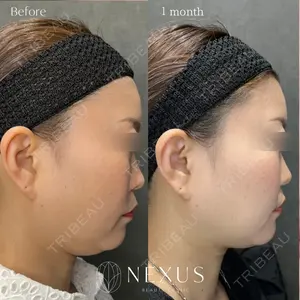 NEXUS CLINIC 渡辺　佳奈医師の症例