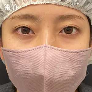 NARU Beauty Clinic 【ナルクリ】 石橋 成彦医師の症例