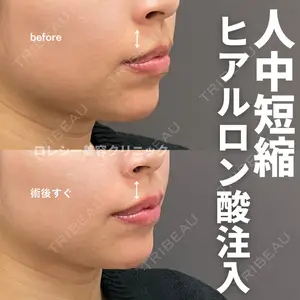 ロレシー美容クリニック 心斎橋駅前院 高田先生医師の症例