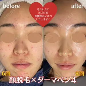 エスクリニック 恵比寿の症例