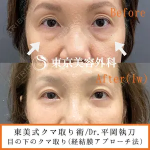東京美容外科 青森院の症例