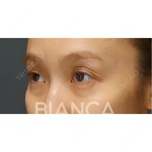 BIANCA銀座 堀田 和亮医師の症例