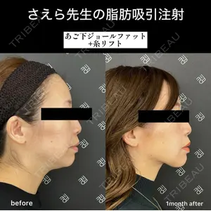 EMMO FACE CLINIC 大阪梅田院 山﨑 冴羅医師の症例