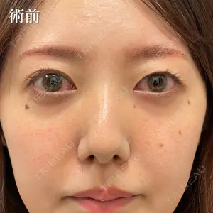 NARU Beauty Clinic 【ナルクリ】 石橋 成彦医師の症例