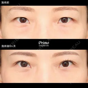 プリモ麻布十番クリニック 大場教弘医師の症例
