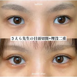 EMMO FACE CLINIC 大阪梅田院 山﨑 冴羅医師の症例