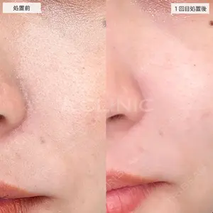 A CLINIC（エークリニック） 池袋院 三橋 克之医師の症例