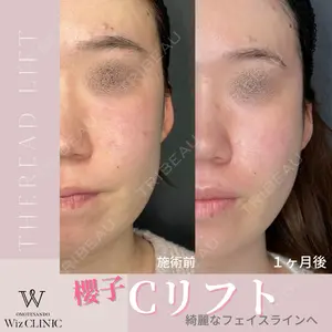 表参道ウィズ・クリニックの症例