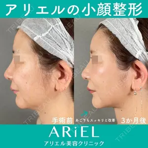 アリエル美容クリニック 大宮院 鈴木　桂介医師の症例