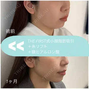 THE FIRST CLINIC 多摩センター院 惟村 公郁医師の症例