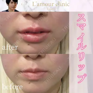L‘amour clinic Tokyo【ラムールクリニック東京】の症例