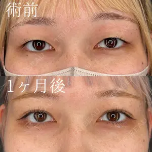 HAAB×DREAM BEAUTY CLINIC 大阪梅田院 柏木 太雅医師の症例