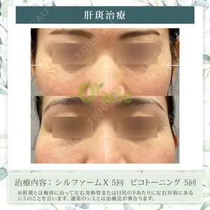 オラクル美容皮膚科 東京新宿院の症例