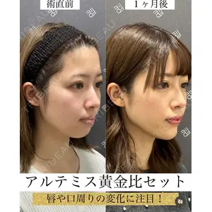 EMMO FACE CLINIC 大宮院 廣松 直樹医師の症例