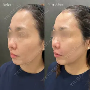 NEXUS CLINIC 富岡 さゆり医師の症例