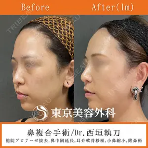 東京美容外科 札幌院 西垣 宏美医師の症例