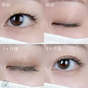 AI Beauty Clinic （エーアイ美容クリニック） 尾崎 宥文医師の症例
