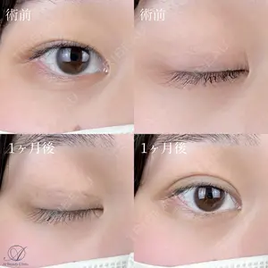 AI Beauty Clinic （エーアイ美容クリニック） 尾崎 宥文医師の症例